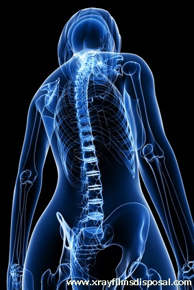 Female Spinal cord X-ray anatomy