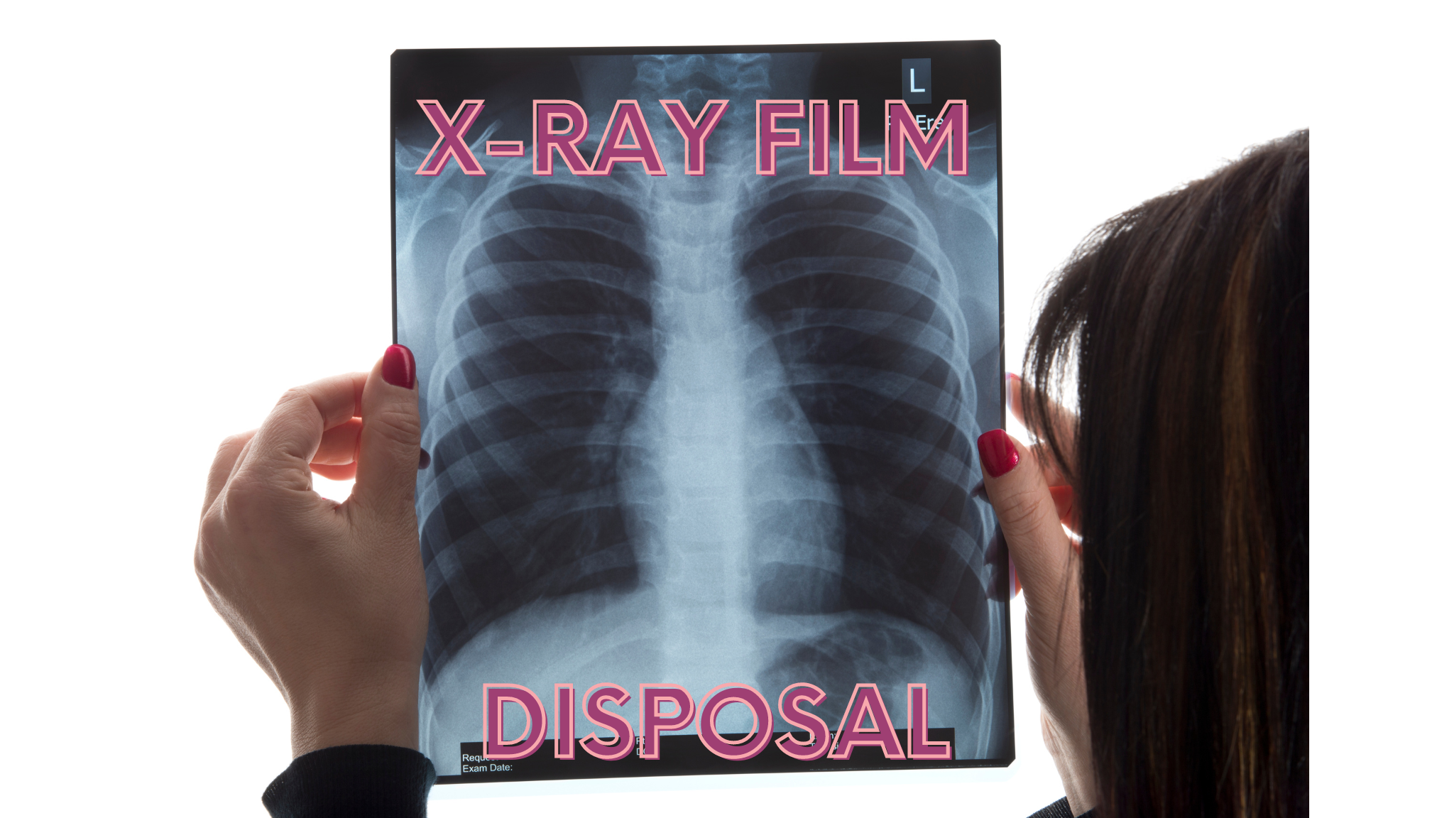 Xray films recycling 